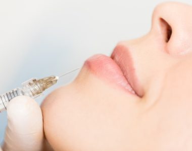 Closeup of dermal fillers being injected in lips and around the mouth to get full lips