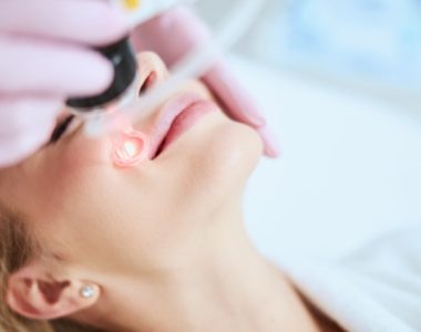 Close up portrait of a blonde woman undergoing the laser skin rejuvenation performed by an experienced dermatologist