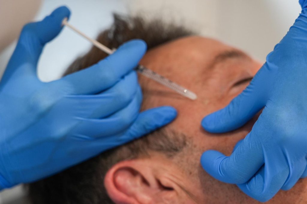 Man getting anti-wrinkle injections for crows feet