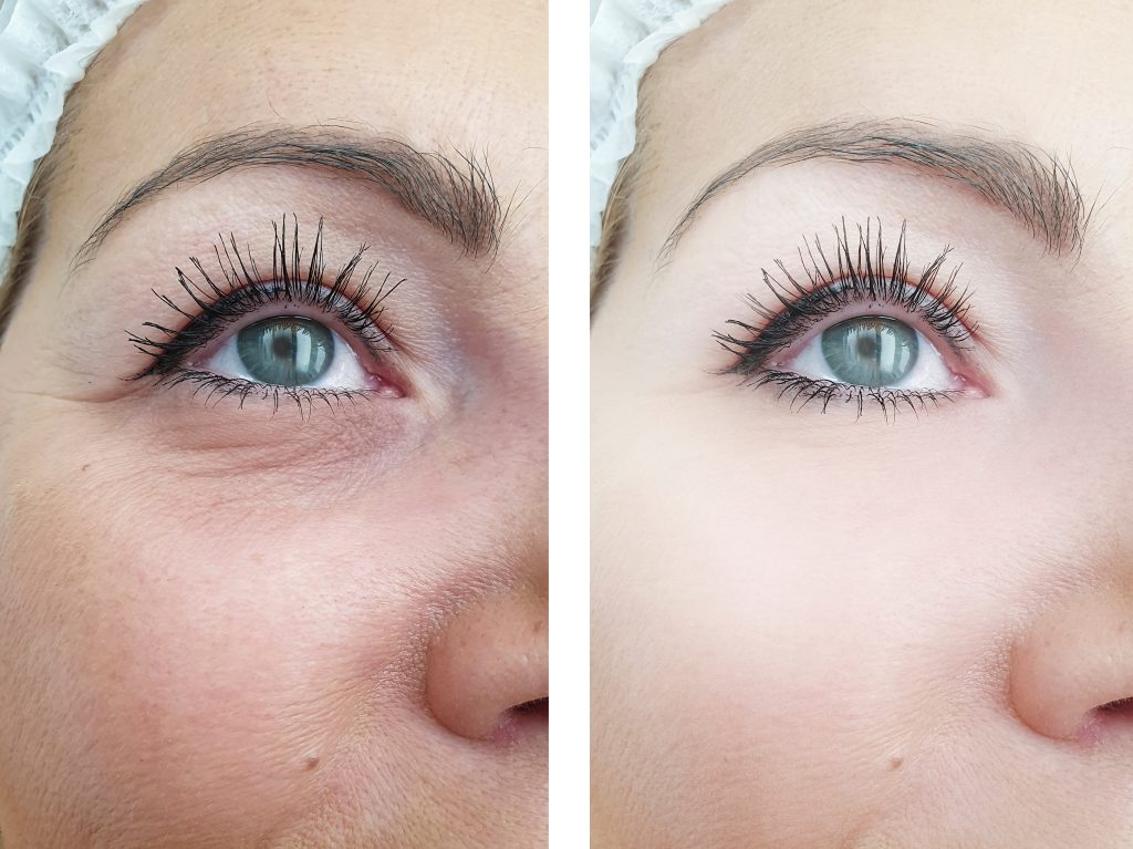 instant eye boost before and after